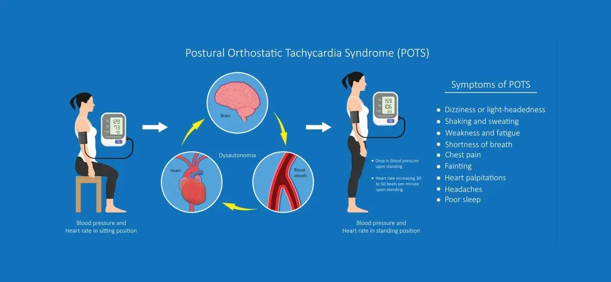 Postural Orthostatic Tachycardia Syndrome (POTS)